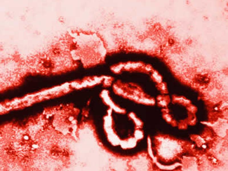 Ebola virus